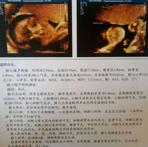 武汉民间供卵试管机构排名揭晓，2023前十人气生殖医院名单公布_裂喉
