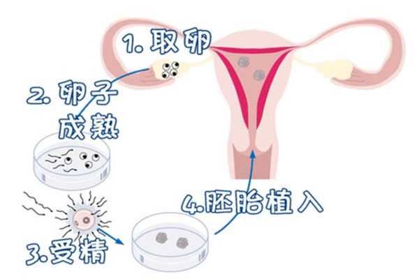 想生孩子切除子宫_卵巢早衰易流产吗_超详细试管婴儿的十大具体步骤流程