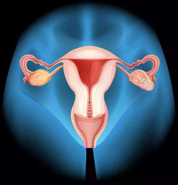 经期过长、不孕可能是子宫肌瘤捣乱，出现这些症状要及时就诊