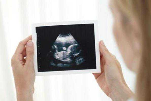 子宫切除能否怀孕_习惯性流产去保胎_马来西亚做三代试管能选择性别吗？